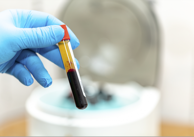 Administración de plasma de recuperados en adultos mayores con COVID-19 reduce gravedad: estudio