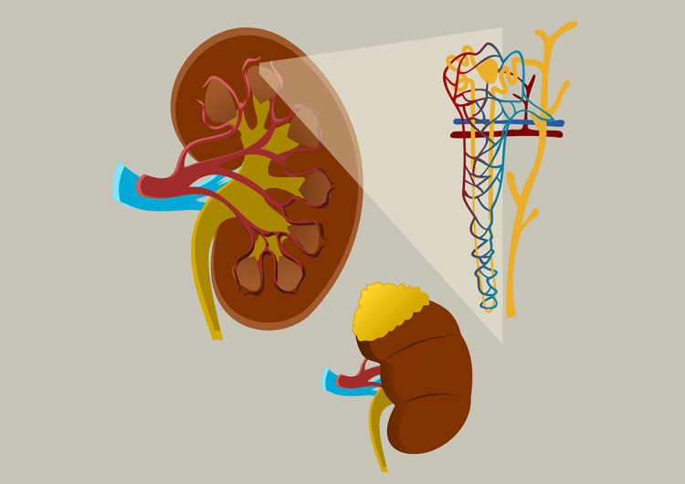 Los hábitos saludables mejoran la condición renal crónica