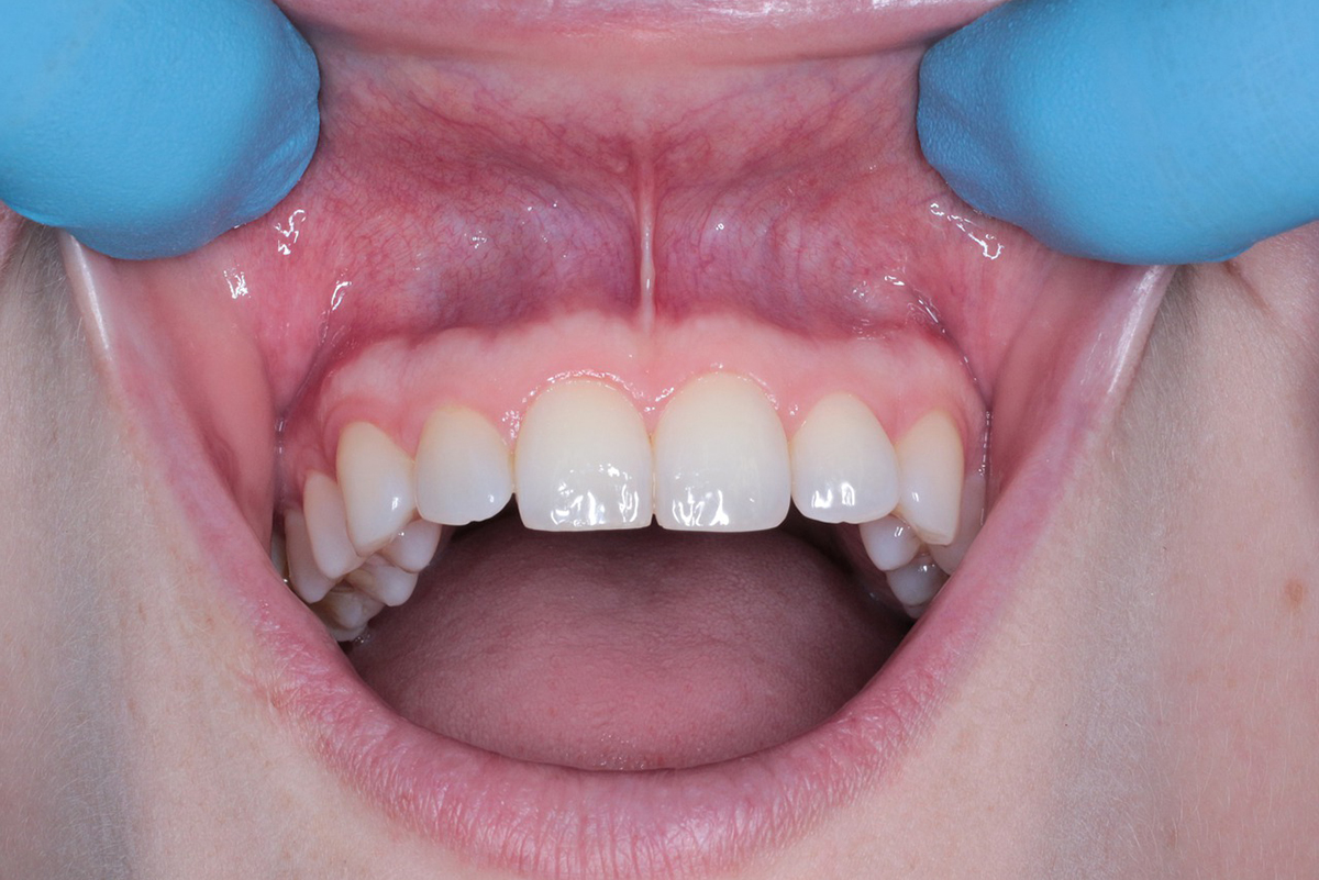 Solo en el caso de urgencia, cuando hay dolor dental agudo, los enfermos han acudido con el odontólogo. Foto: Mauro1984/Pixabay