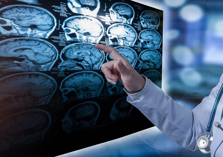 Esclerosis múltiple: la enfermedad de las mil caras