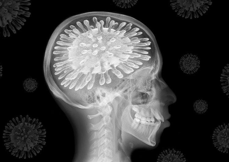 Covid-19, una puerta abierta para el déficit cognitivo