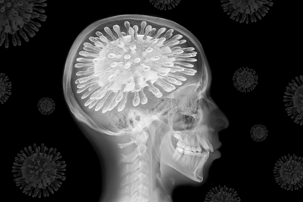 Los virus entran por la nariz y se incrustan dentro de la materia cerebral. (Foto: Adobe Stock)