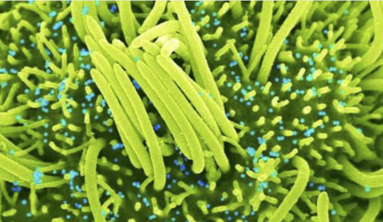 Científicos descubren virus similares al SARS-CoV‑2 en murciélagos; ‘son capaces de infectar células humanas’
