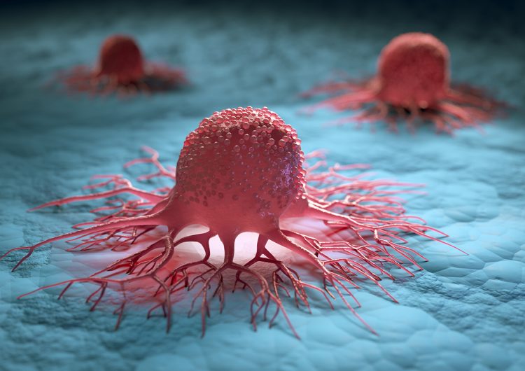 Cáncer hereditario: esto es lo que debes saber
