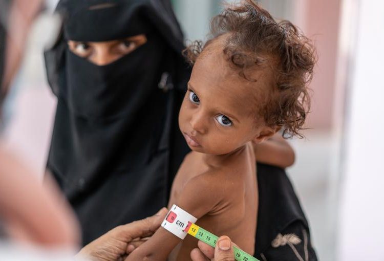 Yemen: 10,000 niños han sido asesinados o mutilados y 400,000 sufren desnutrición aguda grave