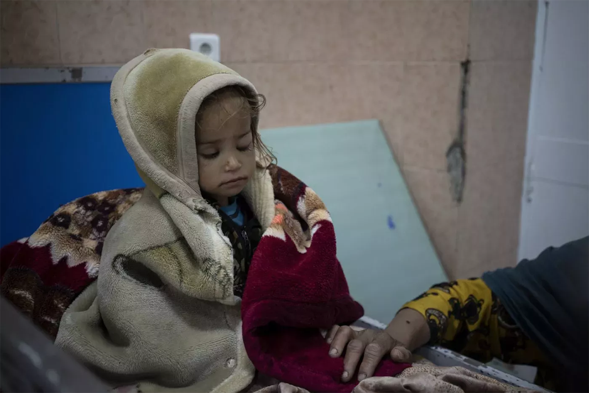 Guldana, de dos años de edad, en una de las camas del Hospital Pediátrico Indira Gandhi de Kabul. (Foto: Bramm Janssen/AP Photo)