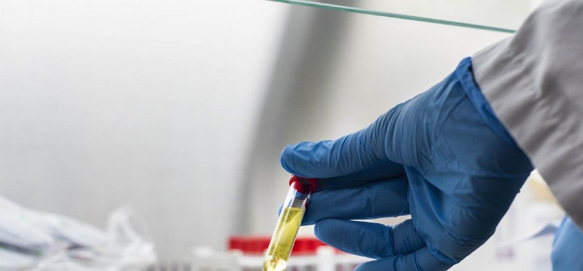 La OMS aprobó nuevas pruebas rápidas de antígenos que se están distribuyendo a nivel mundial. Foto: WHO Africa
