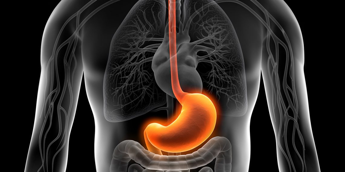 Para tratar la acidez estomacal es importante primero conocer qué es y cómo se desarrolla. (Foto: Adobe Stock)