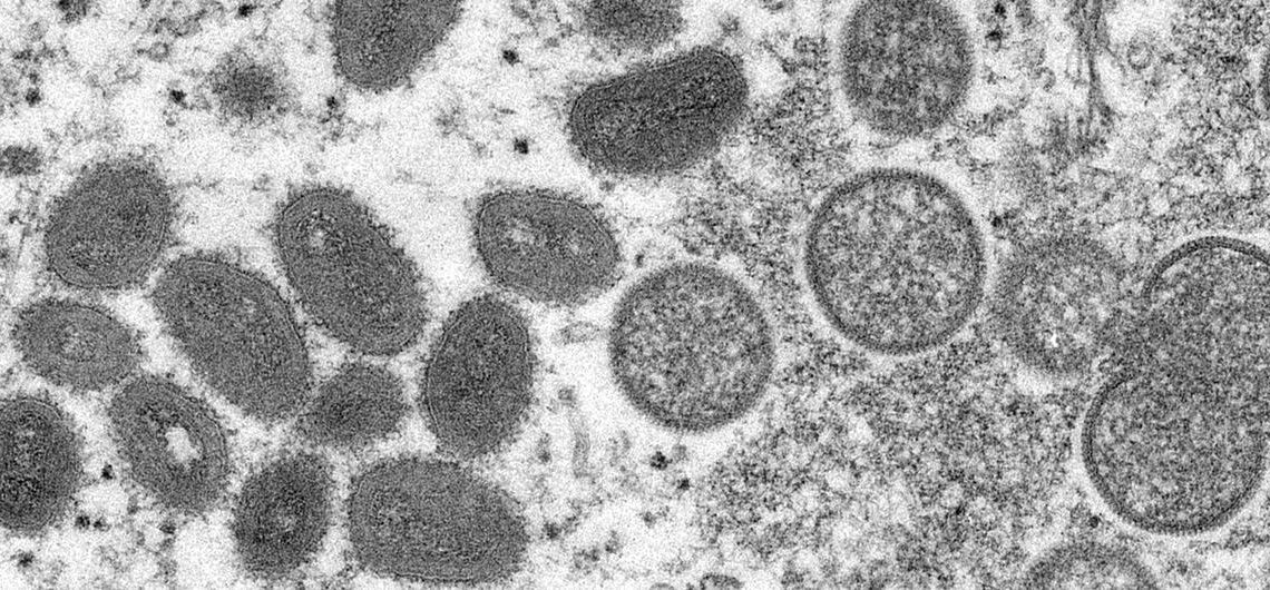 La viruela de mono es una infección rara pero peligrosa similar al virus de la viruela ahora erradicado. (Foto: CDC/Cynthia S. Orfebre)