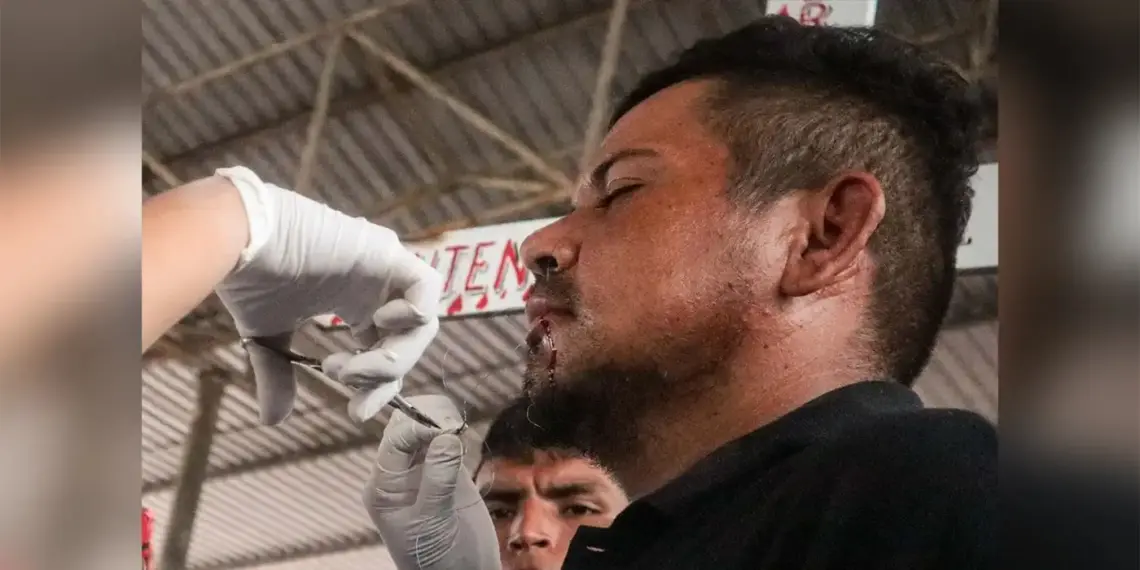 Migrantes México cosen labios
