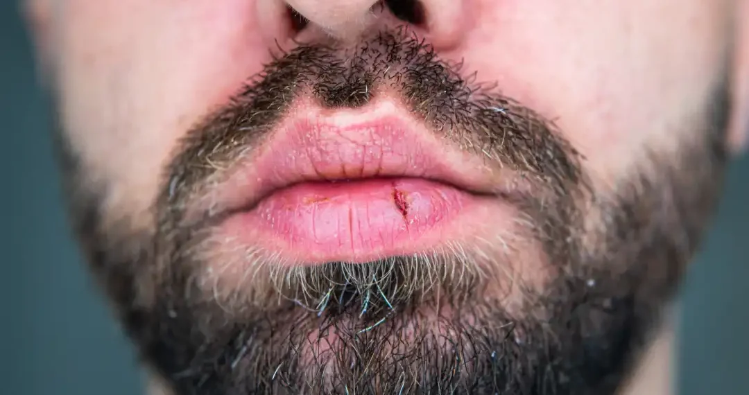 Tus labios dicen mucho más de lo que crees. (AdobeStock)