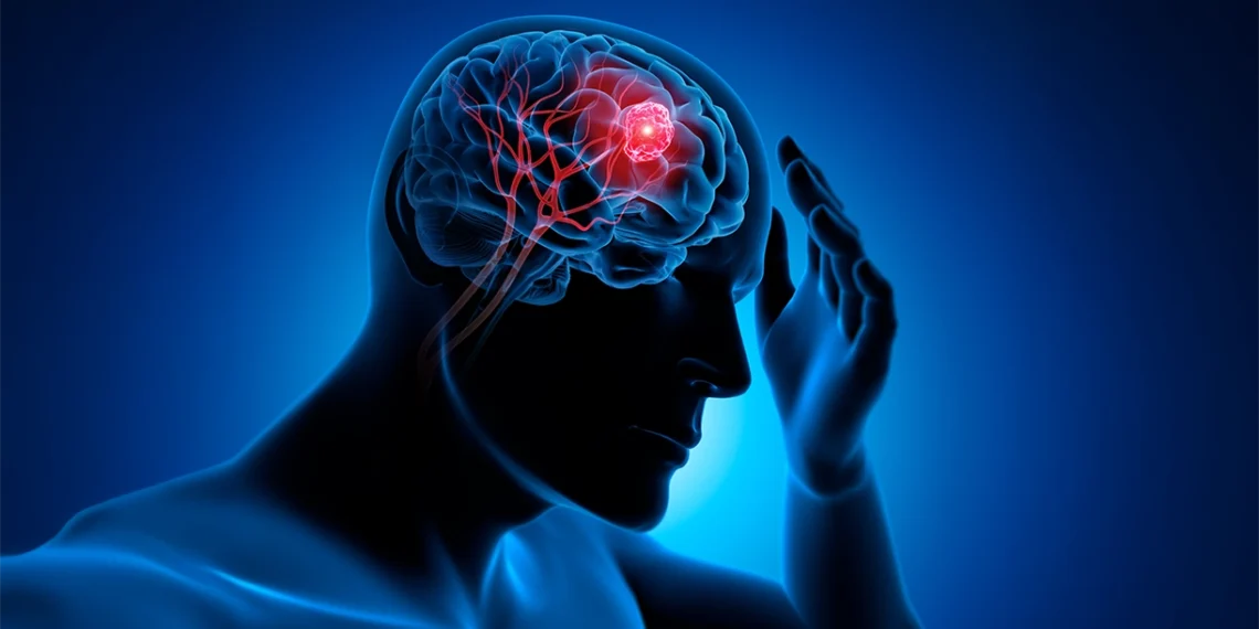 tumores cerebrales